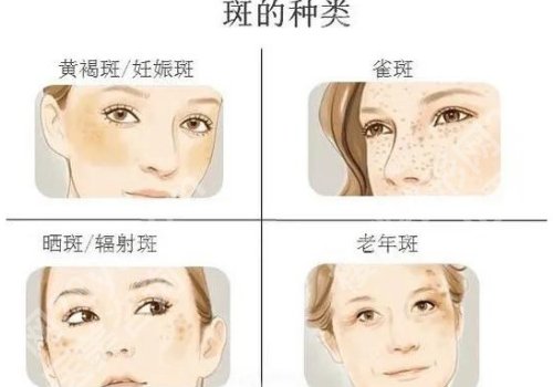 八大处祛斑挂什么号？线上|线下都可选，挂激光美容中心！