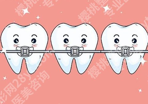 上海九院牙齿矫正价格表，一般需要多少钱？1.5w元起，口碑点评+案例