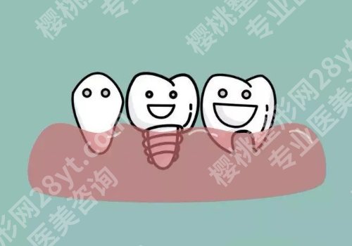 上海九院口腔修复科哪个医生好？莫嘉骥、顾迎新、赖红昌人气超高！