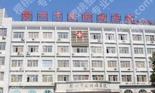 赣州市皮肤病医院做植发手术怎么样？附植发案例|注意事项了解