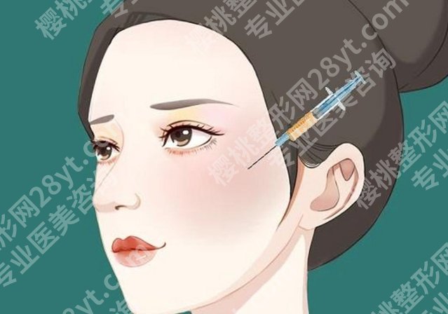 上海九院除皱打元气针多少钱？维持时间、除皱效果、性价比全方位分析