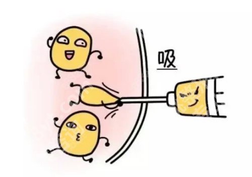 上海九院抽脂怎么样?轻松拥有曲线身材!医院优势、口碑评价、真实案例曝光