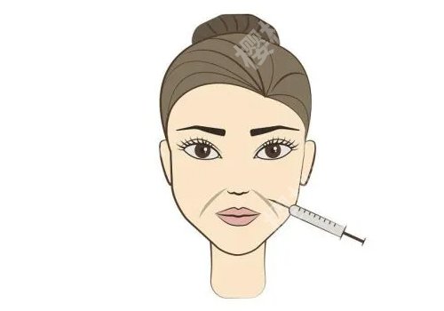 西京医院整形科脂肪填充案例展示!一文讲述案例和优势!附价格表!