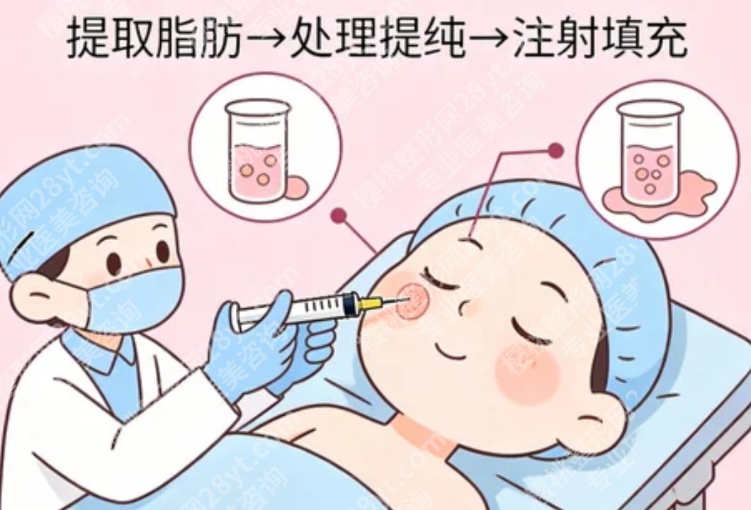 西京医院脂肪填充怎么样？、饱满度和自然度效果综合评价