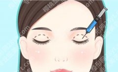 西安西京医院全切双眼皮价位，费用包含什么、加项坑点提前避开