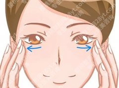 西京医院祛除眼袋手术多少钱？术前检查、麻醉方式才是关键变量