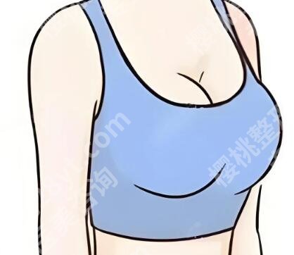 山东省立医院隆胸价格是多少？费用明细，顾客点评分享，小白收藏版