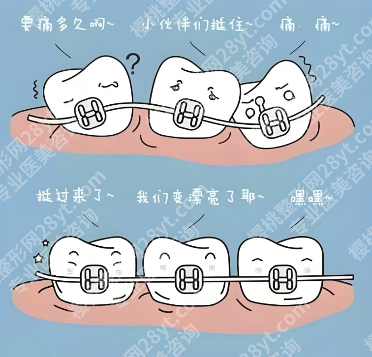 浙医二院正畸怎么样？数字化赋能的隐形正畸革命