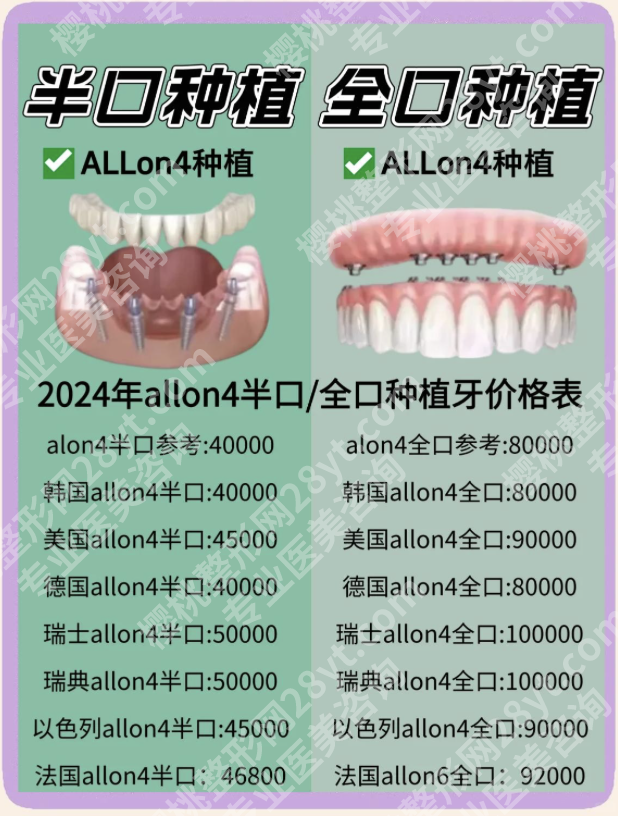 四川华西医院种植牙价格表：个性化方案的费用明细