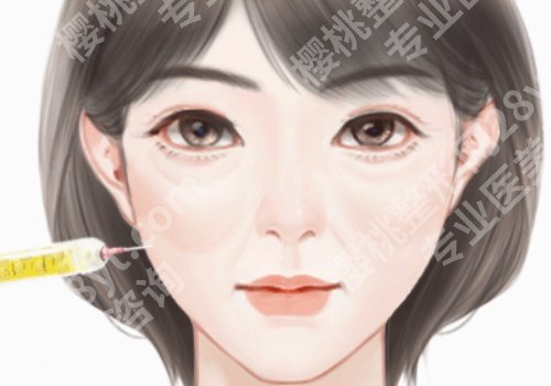 上海第九整形美容医院脂肪填充效果怎么样？真人案例分享