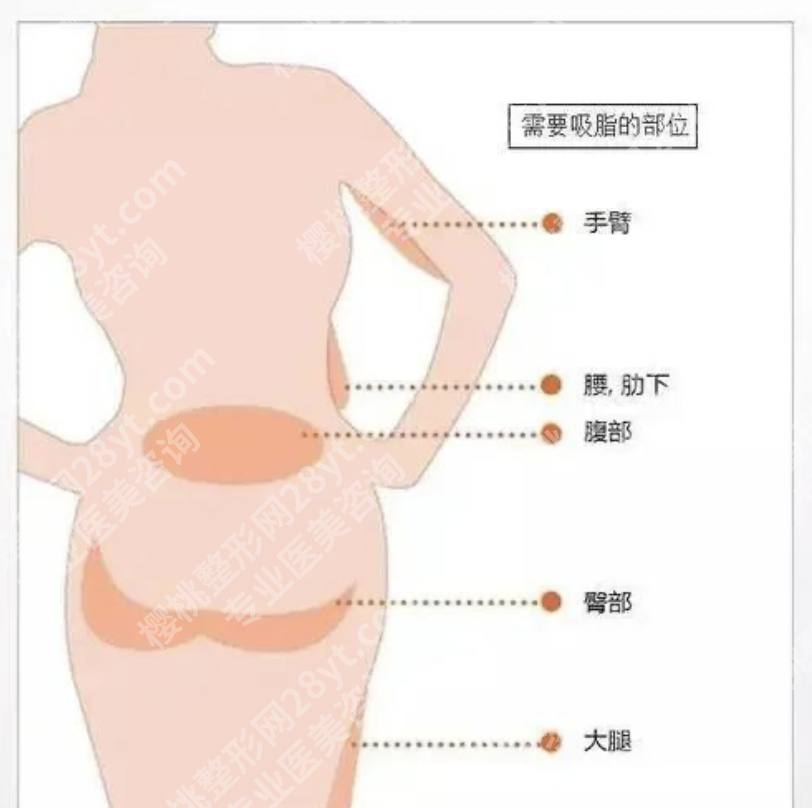 301医院抽脂怎么样？手术的多维揭密与真实图鉴