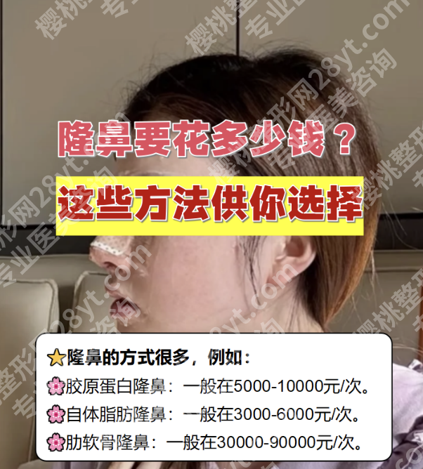 北医三院隆鼻多少钱？不同术式+材料，差价能差3倍