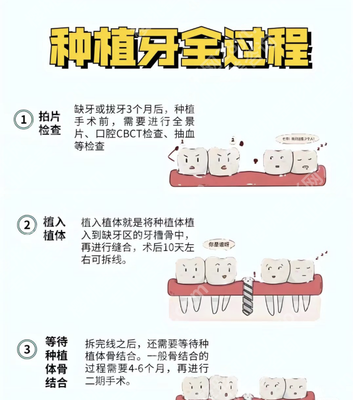 吉大一院种牙水平咋样？内行人深扒，优势、坑点全攻略