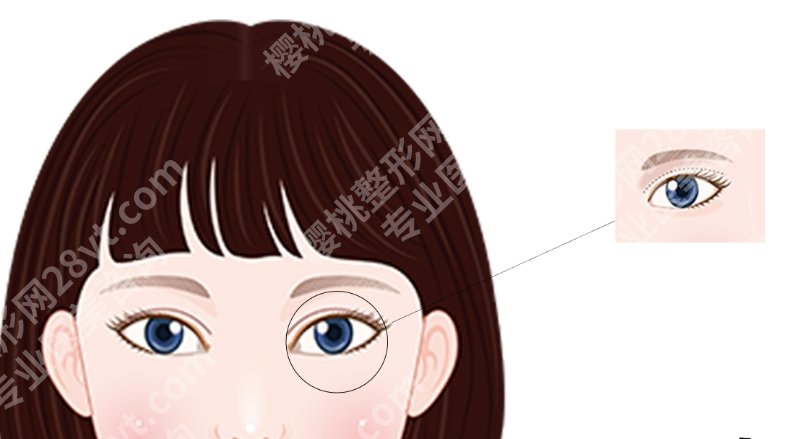 浙一做眼袋费用，术前检查、手术费、麻醉费大致各占多少？