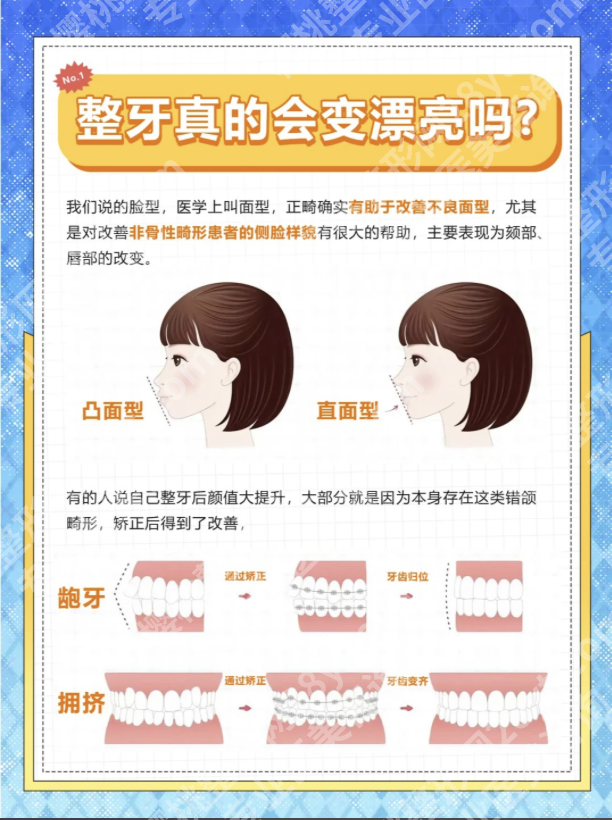 浙一医院整牙好吗？别盲目跟风，看完这篇再决定
