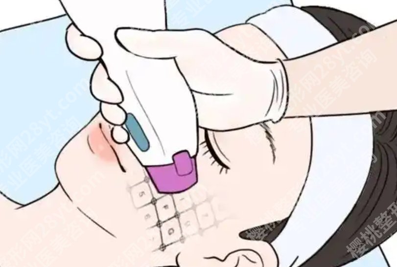 华西医院皮肤美容科有热玛吉?项目设置、适应人群和预约方式说明