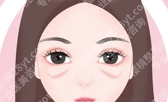 浙医二院去眼袋挂什么科？正确科室+流程指引来了