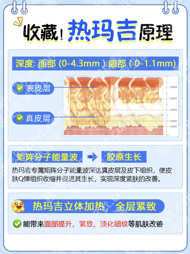 上海三甲医院热玛吉特色解析：选择比努力更重要
