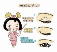上海9院割双眼皮哪位医生好？2026新医生盘点+风格对比+预约攻略