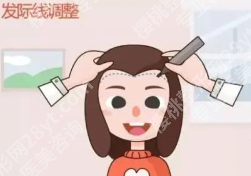上海九院植发价格是多少？大约1.5万元起、发际线调整、头顶加密都能做