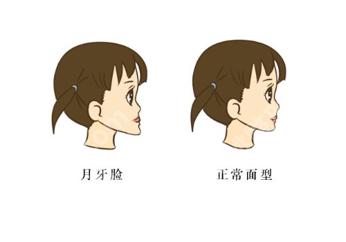 上海九院正颌手术费用多少钱？1万元起，人气医生与面诊建议分享！