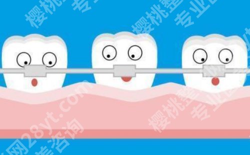 上海九院牙齿矫正价格表更新！低至于9800元起、实力雄厚