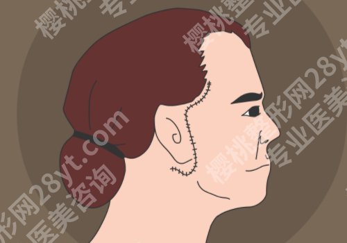 上海第九人民医院做拉皮哪位专家好？金云波、杨娴娴等值得推荐