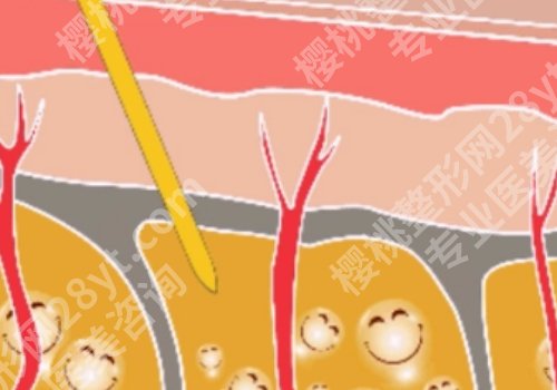 上海第九整形医院抽脂医生谁好？周双白、薛珂人气较高！网友案例曝光！