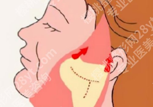 八大处拉皮手术好的专家有哪些？侯典举，杨明勇实测不假脸！