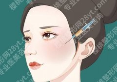 浙一医美针剂哪个医生好？几类注射医生特点盘点：自然派、精雕派各有谁
