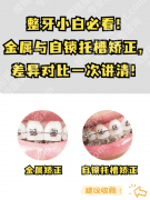 浙二矫正牙齿好还是省口好？正畸两大王牌全维度实测对比