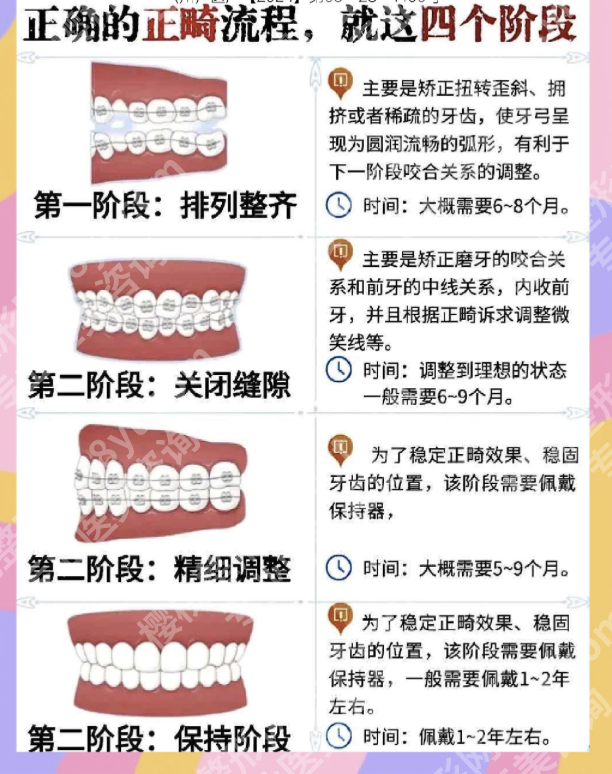 山东省立医院正畸怎么样？不只是“排齐牙齿”，更是一场精准的美学工程