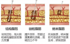 华西脂肪填充怎么样啊？这篇实测帮你避掉99%的雷