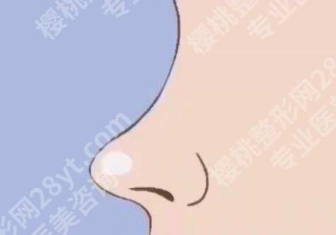 山东省立医院整形外科在哪个院区？科室资料、常见问题一一揭晓
