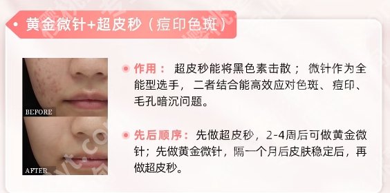华美热玛吉哪个医生好？院内实力医生雄厚附项目价格参考！