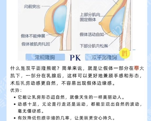浙一医院假体隆胸专家新鲜出炉！看看有哪些医生上榜吧！