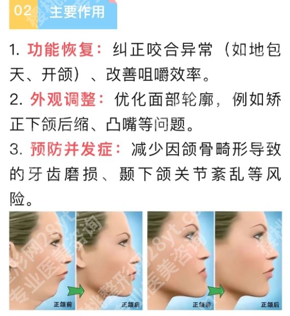 吉大一院正颌手术怎么样？真实的顾客点评分享快来参考!