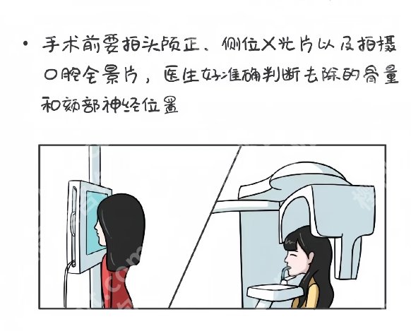 深圳北大医院磨骨怎么样？精准轮廓重塑的选择!