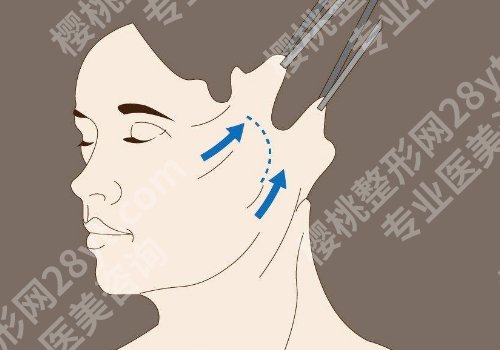 上海九院整形拉皮专家哪个好？高博闻、杨娴娴、丁伟抗衰界的扛把子