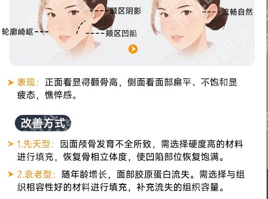 北京301医院割双眼皮怎么样?安全与效果的可靠选择!