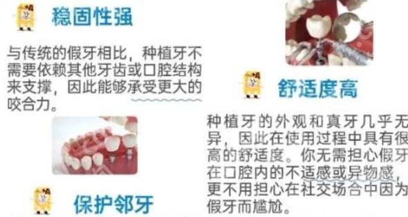 山东省立医院口腔科哪个医生好?吴海威、赵文、吴益华均上榜!
