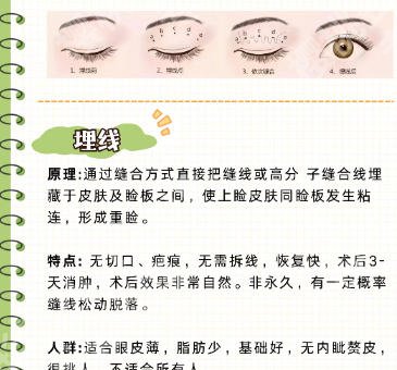南方医院眼部整形哪个医生好？冯传波、罗勇等医生技术实力双优！