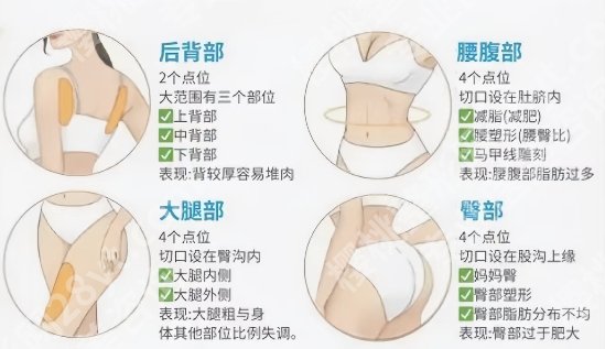 华西抽脂哪个医生好?肖海涛、唐军、邓珂医生均上榜!