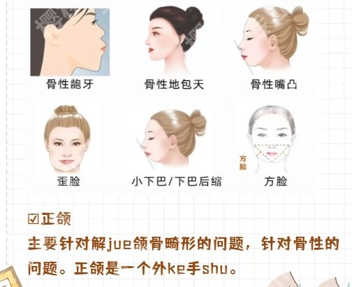 华西医院正颌手术费跟上海九院哪个贵!两家医院资质大pk!