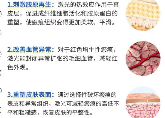 华西医院去疤痕技术怎么样？附术后注意事项一站式参考！