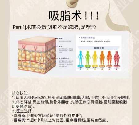 山东省立医院吸脂案例展示！让你重拾自信恢复理想身材！