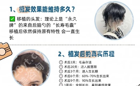 浙一医院可以种头发吗？医院技术优势及顾客点评全解析！