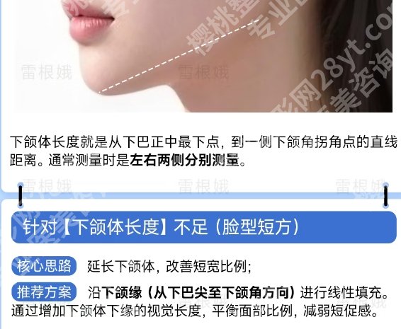 浙一医院做下颌角手术费用！根据个人情况为您量身定制方案！