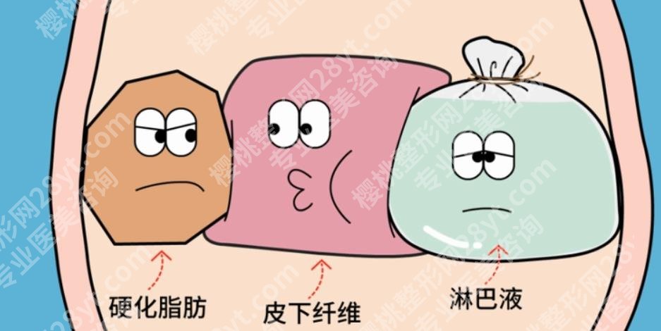北医三院抽脂价格贵不贵？腰腹33800元左右起|详情解析
