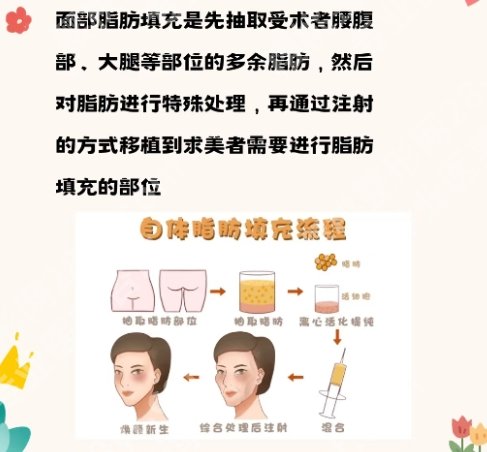 北医三院脂肪填充怎么样？面部年轻化效果解析！
